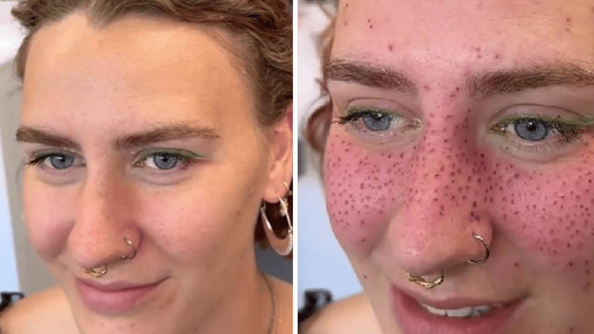 People divided over new trend of tattooing 'permanent freckles' on your