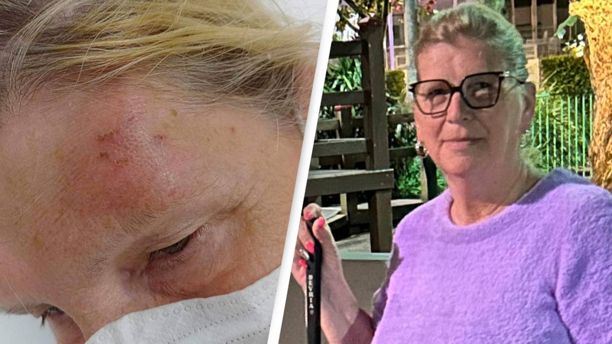 Australian grandmother bitten by bat fears she may have deadly ...