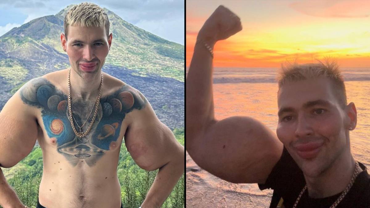 Russian 'Popeye' Proudly Maintains His Synthol-Induced 24-Inch Freakish  Biceps Despite Suffering From Health Issues in the Past - EssentiallySports