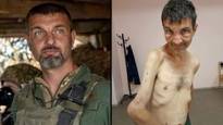 Ukraine prisoner of war shows shocking toll captivity had on his body