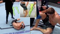 Horror knee injury leaves UFC viewers wincing