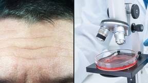 研究人员已成功地逆转了人类皮肤细胞的衰老