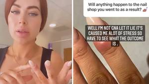 Love Island's Jess Hayes' Warning After Nail Infection
