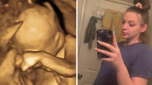 Woman Shares Tragic Reality Of Carrying Baby Who Is ‘Incompatible With Life’ After Roe Vs Wade Reversal