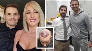 Married At First Sight UK Star Luke Dawson Shares Pictures Of Dramatic Hair Transplant Procedure