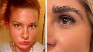 Woman Has To Trim Her Eyebrows Monthly After Transplant