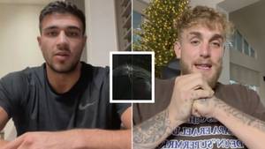 Tommy Fury Shows Off Injury After Pulling Out Of Jake Paul Fight