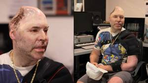 Rapper Who Lost Half His Skull Says He's 'Paying Price For Mistake'