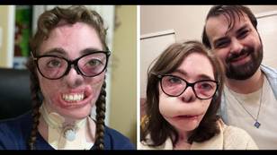 Dogsitter who had most of her face torn off by two dogs shows off results of reconstructive surgery