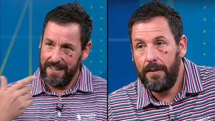 Adam Sandler Forced To Explain After Appearing On TV With Black Eye