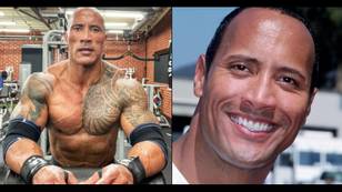 Dwayne Johnson had male breast reduction surgery to eliminate the appearance of man boobs