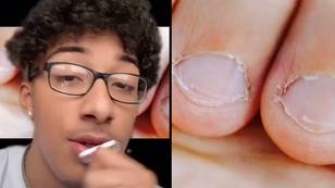 Shocking footage shows the reason why you should never bite your nails