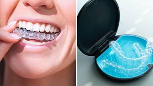 Dentists warn about damage caused to teeth by clear braces