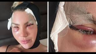 Love Island star Mollie Salmon slams fans who say fox eye surgery 'ruined' her face