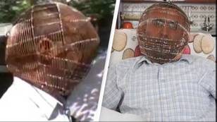 Man locks own head in cage in desperate attempt to quit smoking