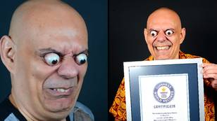Man sets new Guinness World Record for farthest eyeball pop
