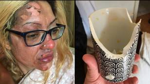 Mother left in 'absolute agony' after trying viral TikTok poached egg hack