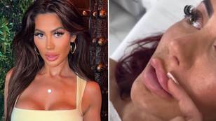 Geordie Shore star Chloe Ferry reveals dramatic makeover after getting lip filler dissolved