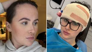 Woman splashes £9,000 on forehead reduction surgery after hiding under fringe for 20 years