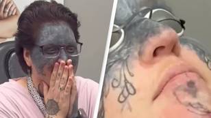 Woman tattooed against her will has life changing removal surgery thanks to complete stranger