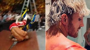Logan Paul shows off injuries after going through a table at WWE Money in the Bank