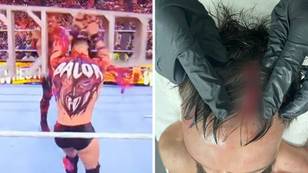 WWE superstar Finn Balor reveals brutal gash suffered in Hell in a Cell match