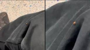 'Bed bug' spotted crawling on Brit’s leg on public transport might not be what it seems