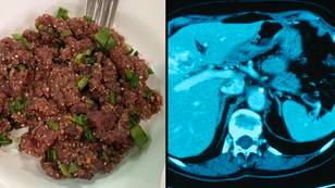 Single bite of Thai dish can give you liver cancer