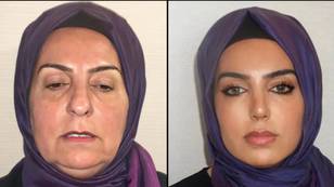 Before and after pictures from Turkish plastic surgery clinic have left people in disbelief