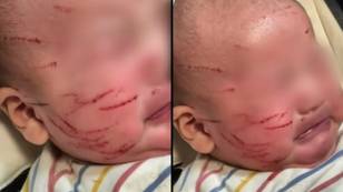 Mum horrified after picking baby up from daycare to find his face scratched all over