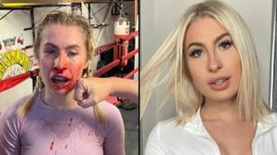 Bloodied Astrid Wett shares brutal results of sparring session one week before fight