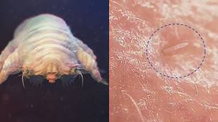 These Mites Have Sex On Your Face And Nipples While You Sleep