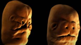 Simulation showing how a baby's face develops is giving people nightmares