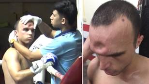 The Moment Muay Thai Boxer Suffered Skull Fracture After Brutal Elbow