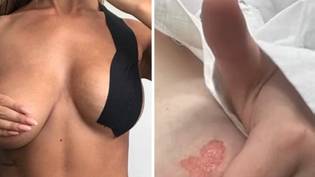 Women Claim Popular Booby Tape Left Them With 'Tears And Scarred Skin'