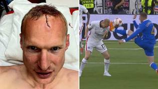 Frankfurt Midfielder Shows Off Stitches After Boot To The Face