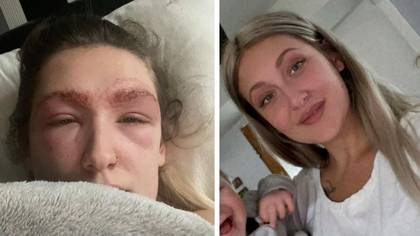Woman rushed to hospital and left unable to see after getting her eyebrows tinted