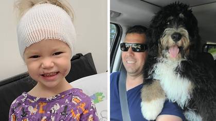Toddler had to undergo three surgeries after losing her ear in family dog attack