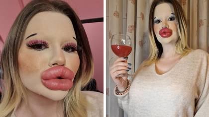 Woman with 'world's biggest lips' now wants to break another record