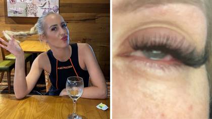Woman Blinded After Making Simple False Eyelash Mistake