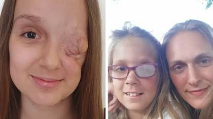 Girl dies from rare cancer despite getting all clear after having eye socket removed