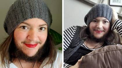 Woman who randomly starting growing facial hair is now embracing it