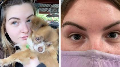 Woman thought she had 'strand of dog hair' in her eye but it turned out to be multiple sclerosis