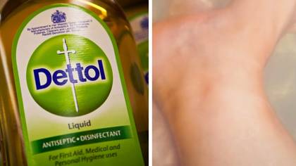 Woman praises Dettol baths for removing stubborn fake tan