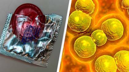 US health officials issue warning as ‘out of control’ STD situation is highest its been since 1948