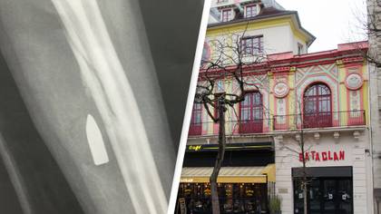 Surgeon Facing Legal Action After Trying To Sell Bataclan Attack Survivor's X-Ray As NFT
