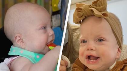 Baby with rare condition is born with adult sized tongue