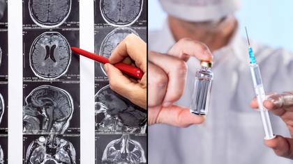 Brain cancer vaccine successfully prolongs patients' survival during Phase 3 trials