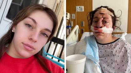 Woman left with life-changing injuries after losing her nose in horror dog attack
