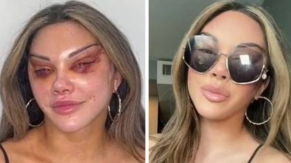 Woman who flew to Turkey for cat eye surgery says she doesn't care what trolls think